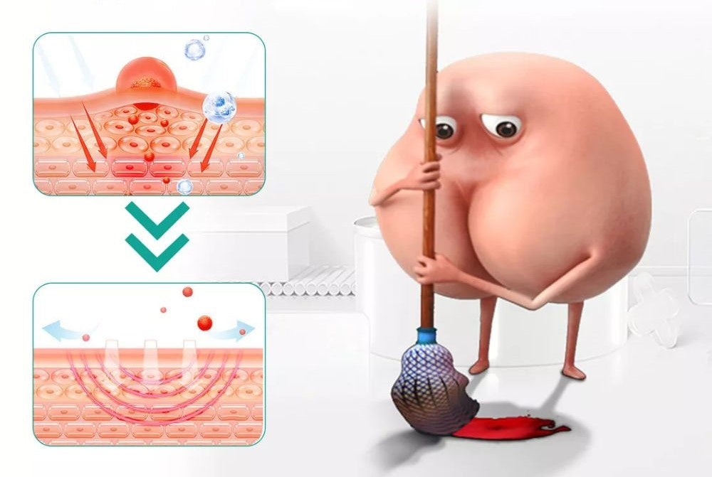 Crema Herbal para Hemorroides