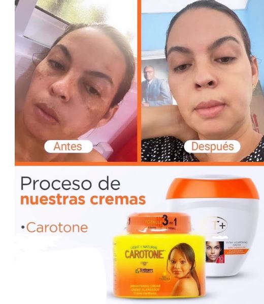 CAROTONE ORIGINAL 135 GR