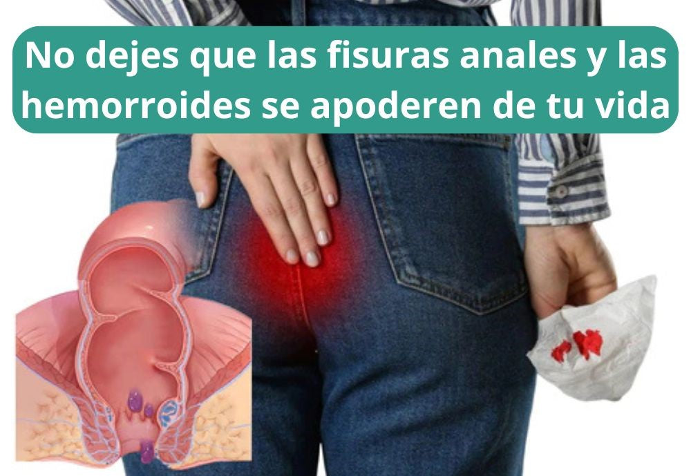 Crema Herbal para Hemorroides